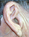 ear-1