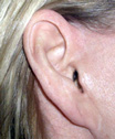 ear-2