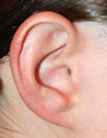 ear-3