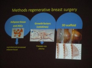 regenerative-brest-surgery