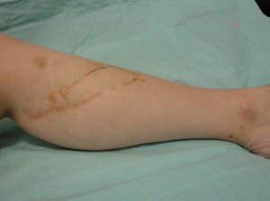 propeller_07_08_2013