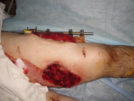 ???????????????????????????????