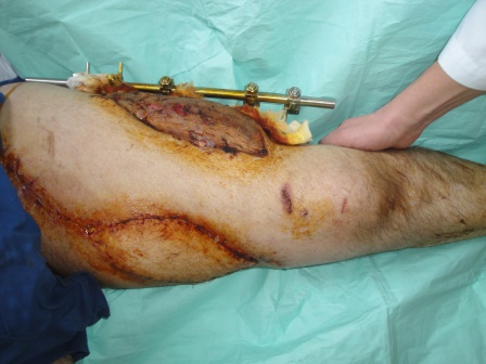 ???????????????????????????????