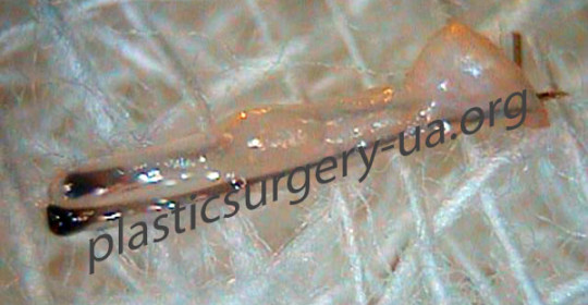 графт-2-волоса1