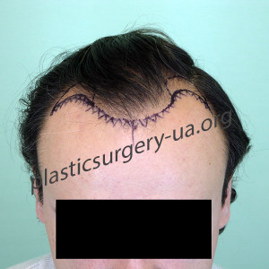 Результат-до1