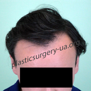 Результат-после1