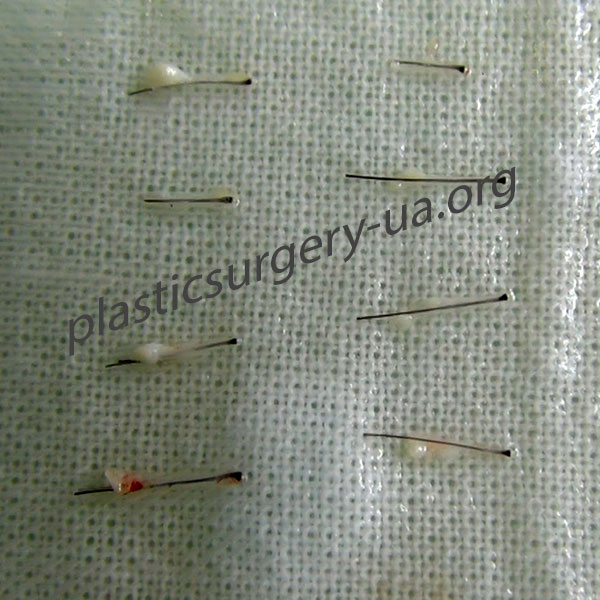 Шаг 4 . Подготовка графтов