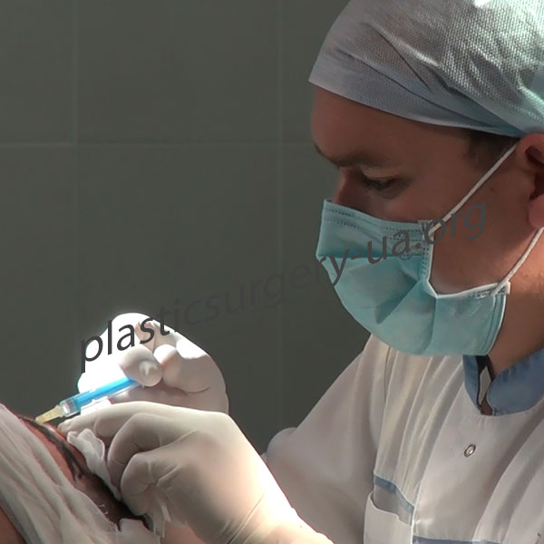 Шаг 4 . Подготовка графтов