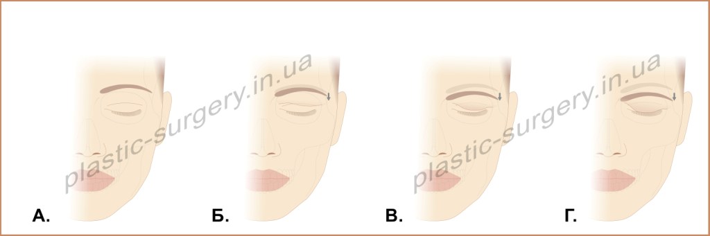 Рисунок_02 pl