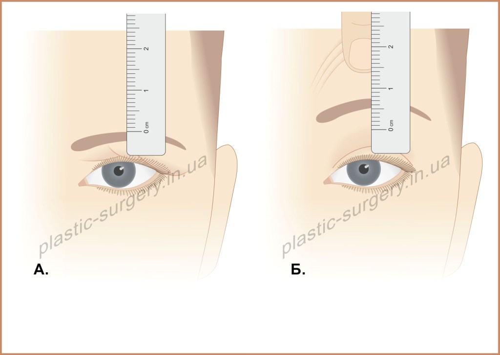 Рисунок_03 pl